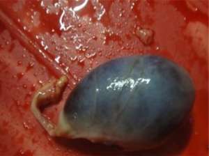 豆腐对男人有5大害处
